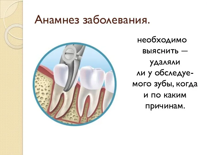 Анамнез заболевания. необходимо выяснить ― удаляли ли у обследуе-мого зубы, когда и по каким причинам.