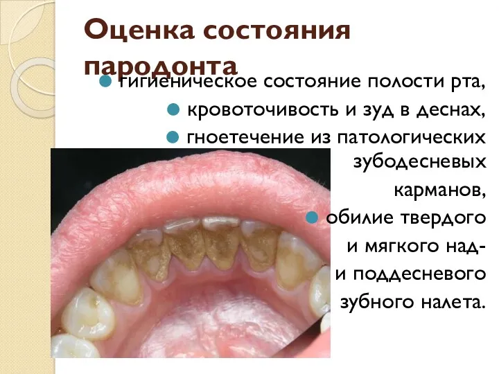 Оценка состояния пародонта гигиеническое состояние полости рта, кровоточивость и зуд
