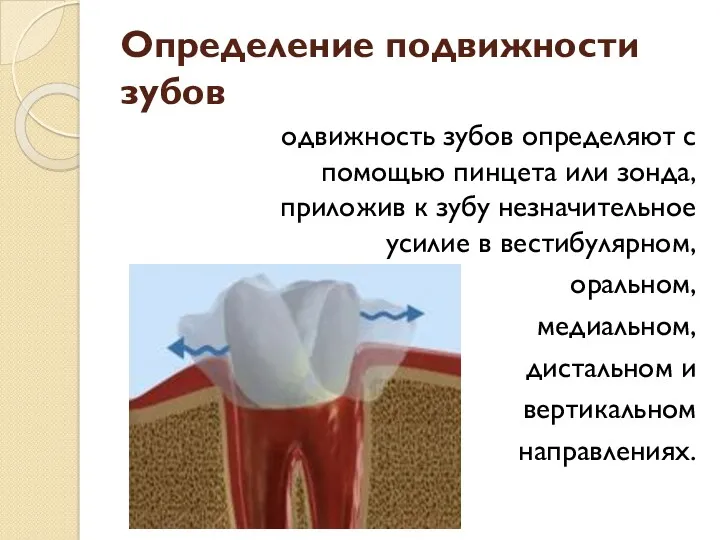 Определение подвижности зубов одвижность зубов определяют с помощью пинцета или