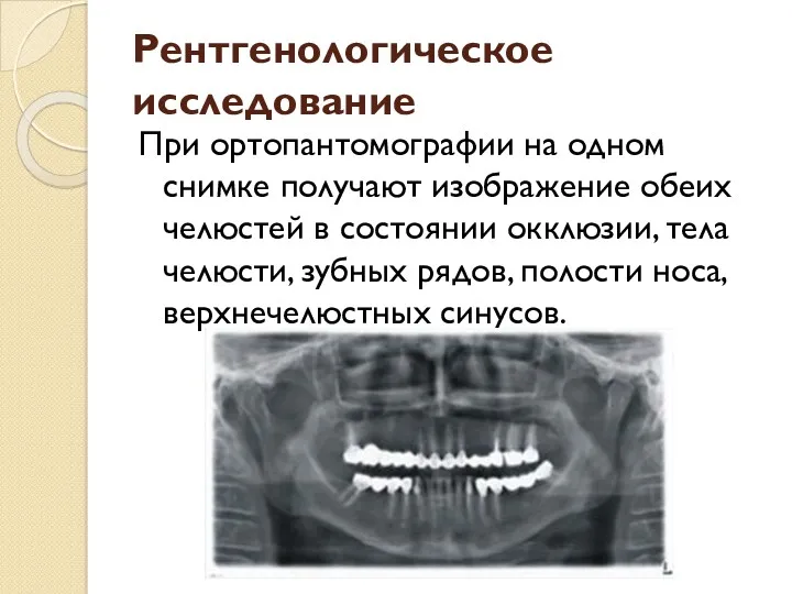 Рентгенологическое исследование При ортопантомографии на одном снимке получают изображение обеих
