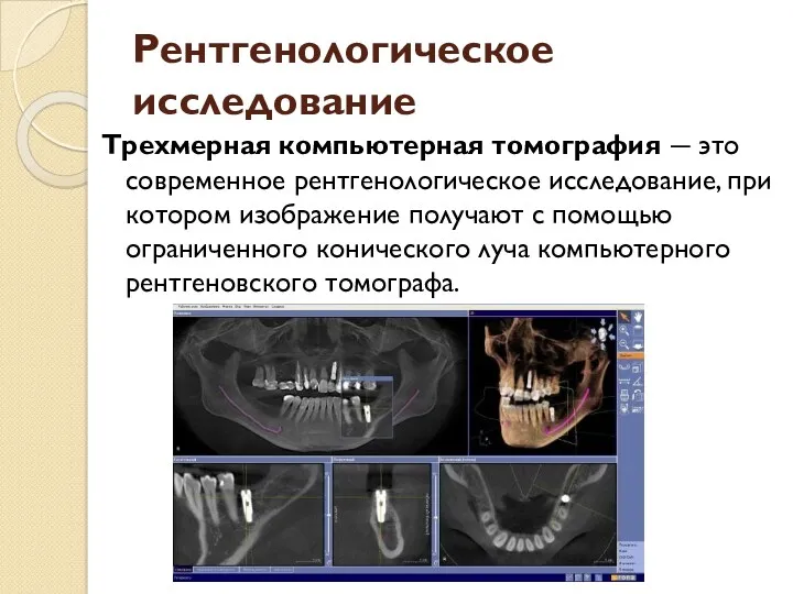 Рентгенологическое исследование Трехмерная компьютерная томография ― это современное рентгенологическое исследование,