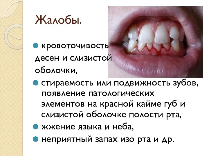 Жалобы. кровоточивость десен и слизистой оболочки, стираемость или подвижность зубов,