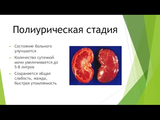 Полиурическая стадия Состояние больного улучшается Количество суточной мочи увеличивается до