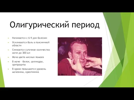 Олигурический период Начинается с 6-9 дня болезни Усиливается боль в