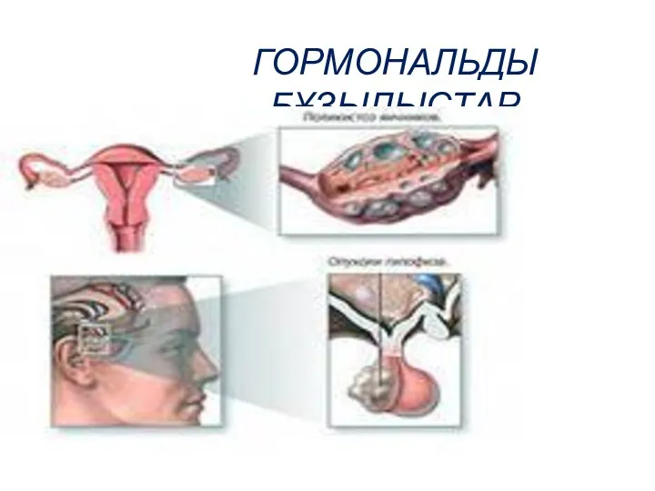 ГОРМОНАЛЬДЫ БҰЗЫЛЫСТАР