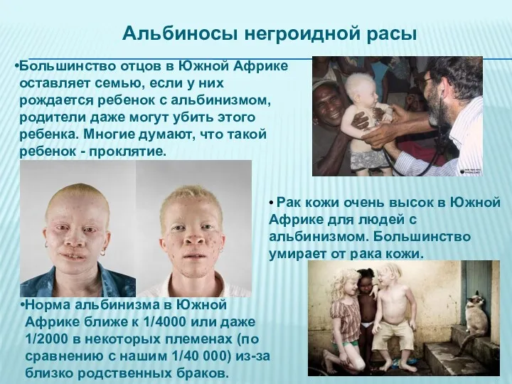 • Рак кожи очень высок в Южной Африке для людей с альбинизмом. Большинство