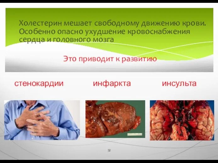 Холестерин мешает свободному движению крови. Особенно опасно ухудшение кровоснабжения сердца и головного мозга