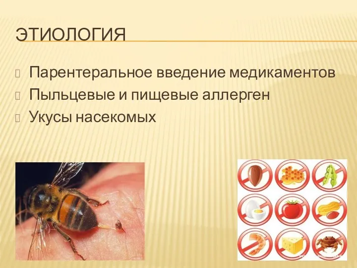 ЭТИОЛОГИЯ Парентеральное введение медикаментов Пыльцевые и пищевые аллерген Укусы насекомых
