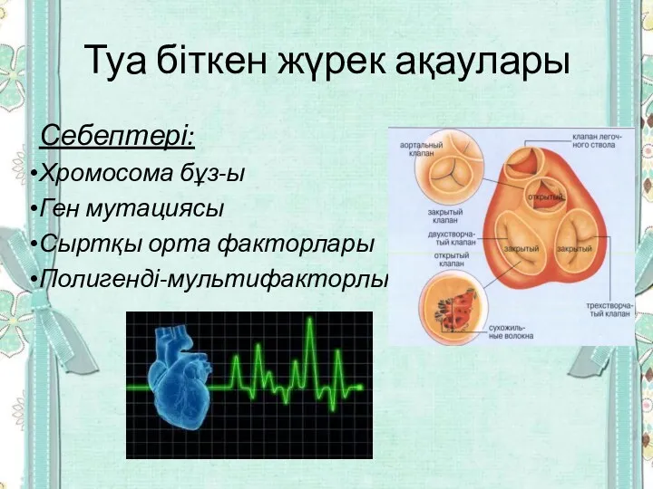 Туа біткен жүрек ақаулары Себептері: Хромосома бұз-ы Ген мутациясы Сыртқы орта факторлары Полигенді-мультифакторлы