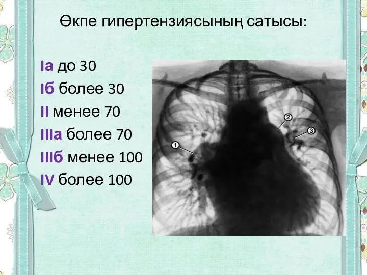 Өкпе гипертензиясының сатысы: Iа до 30 Iб более 30 II