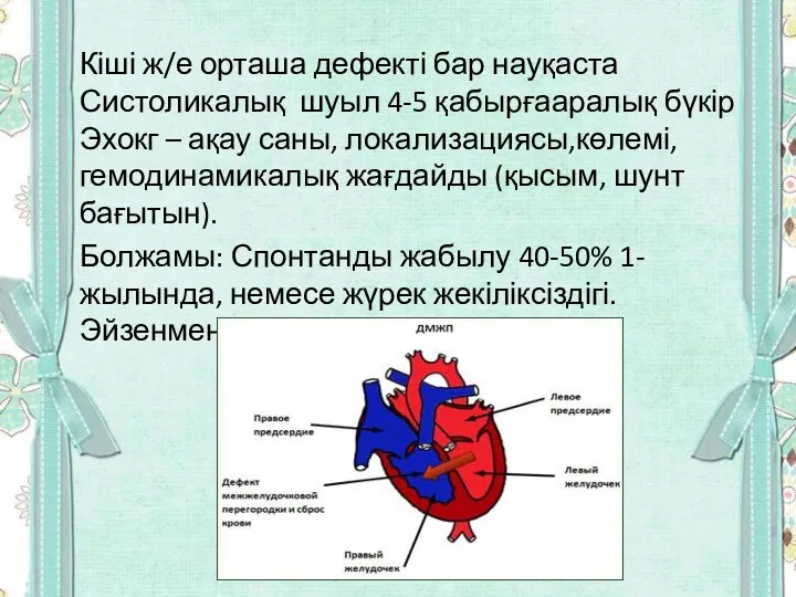 Кіші ж/е орташа дефекті бар науқаста Систоликалық шуыл 4-5 қабырғааралық