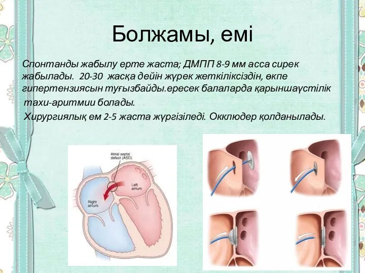 Болжамы, емі Спонтанды жабылу ерте жаста; ДМПП 8-9 мм асса