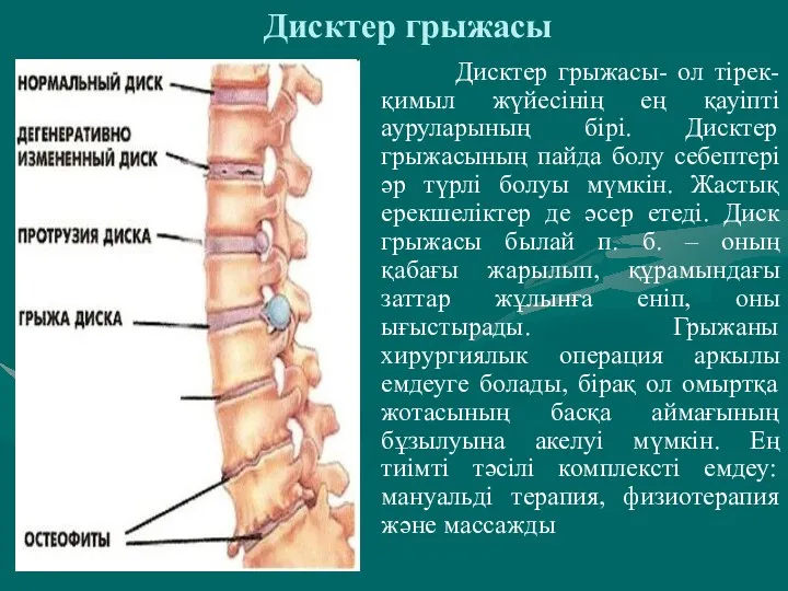 Дисктер грыжасы Дисктер грыжасы- ол тірек-қимыл жүйесінің ең қауіпті ауруларының бірі. Дисктер грыжасының