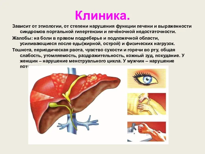 Клиника. Зависит от этиологии, от степени нарушения функции печени и