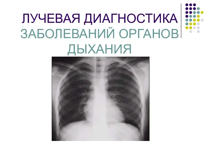 Лучевая диагностика заболеваний органов дыхания