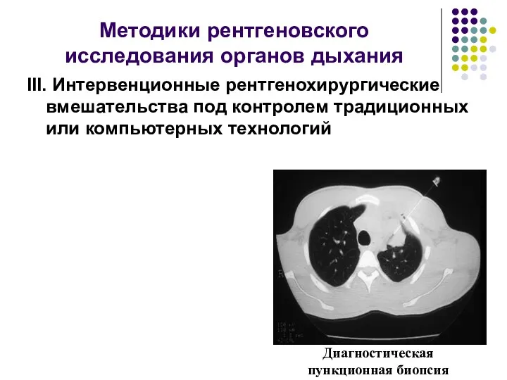 Методики рентгеновского исследования органов дыхания ІІІ. Интервенционные рентгенохирургические вмешательства под