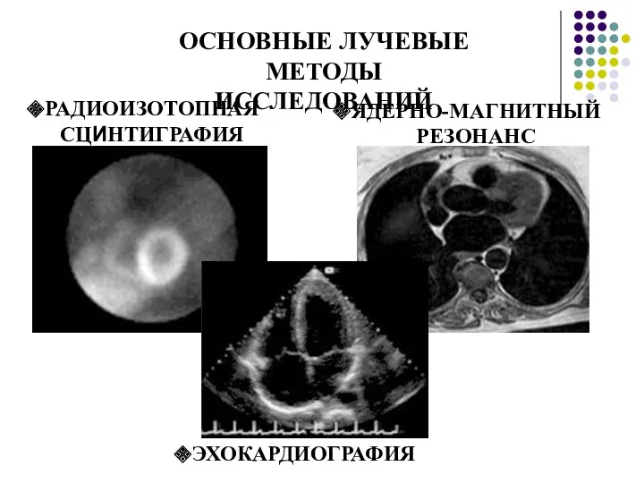 ОСНОВНЫЕ ЛУЧЕВЫЕ МЕТОДЫ ИССЛЕДОВАНИЙ РАДИОИЗОТОПНАЯ СЦИНТИГРАФИЯ ЯДЕРНО-МАГНИТНЫЙ РЕЗОНАНС ЭХОКАРДИОГРАФИЯ