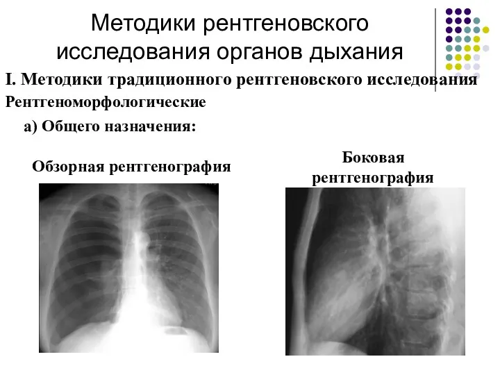 Методики рентгеновского исследования органов дыхания Боковая рентгенография