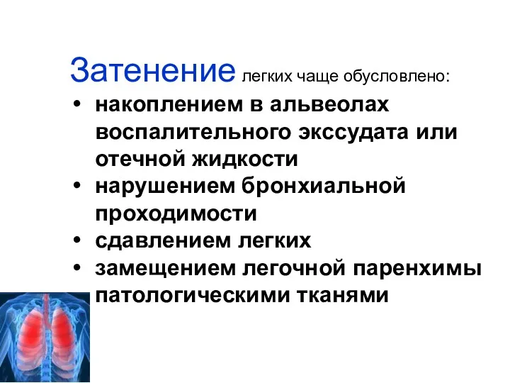 Затенение легких чаще обусловлено: накоплением в альвеолах воспалительного экссудата или