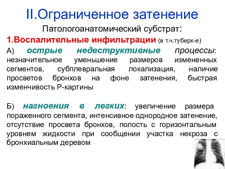 II.Ограниченное затенение Патологоанатомический субстрат: 1.Воспалительные инфильтрации (в т.ч.туберк-е) А) острые