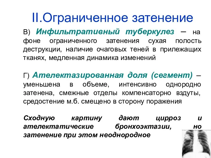 II.Ограниченное затенение В) Инфильтративный туберкулез – на фоне ограниченного затенения