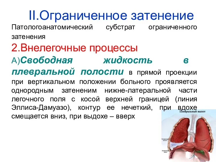 Патологоанатомический субстрат ограниченного затенения 2.Внелегочные процессы А)Свободная жидкость в плевральной