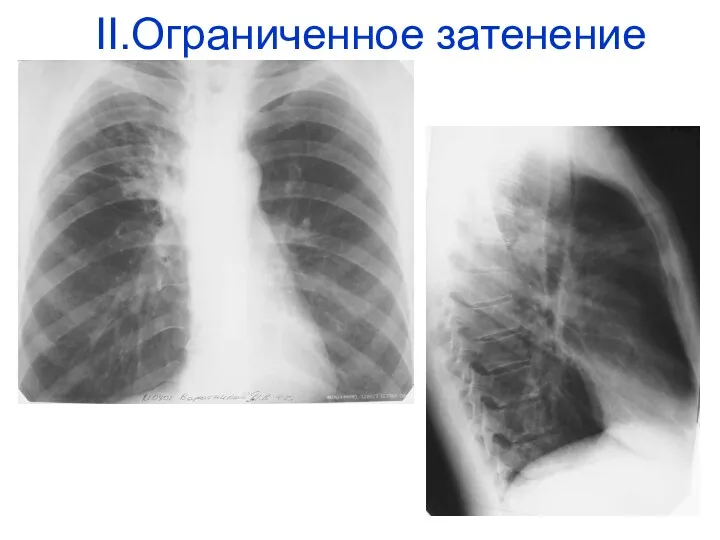 II.Ограниченное затенение