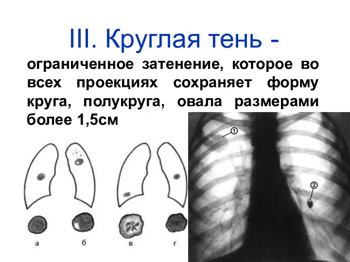 III. Круглая тень - ограниченное затенение, которое во всех проекциях