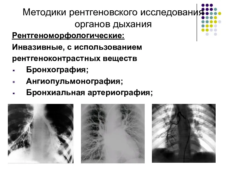 Методики рентгеновского исследования органов дыхания Рентгеноморфологические: Инвазивные, с использованием рентгеноконтрастных веществ Бронхография; Ангиопульмонография; Бронхиальная артериография;