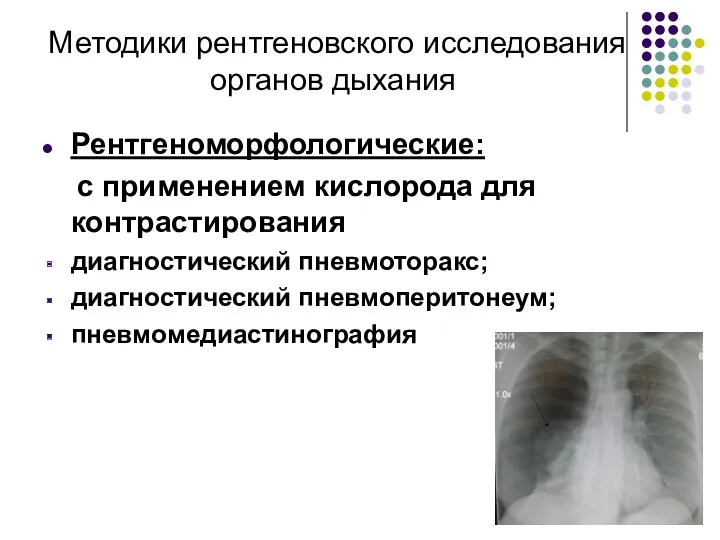 Методики рентгеновского исследования органов дыхания Рентгеноморфологические: с применением кислорода для контрастирования диагностический пневмоторакс; диагностический пневмоперитонеум; пневмомедиастинография