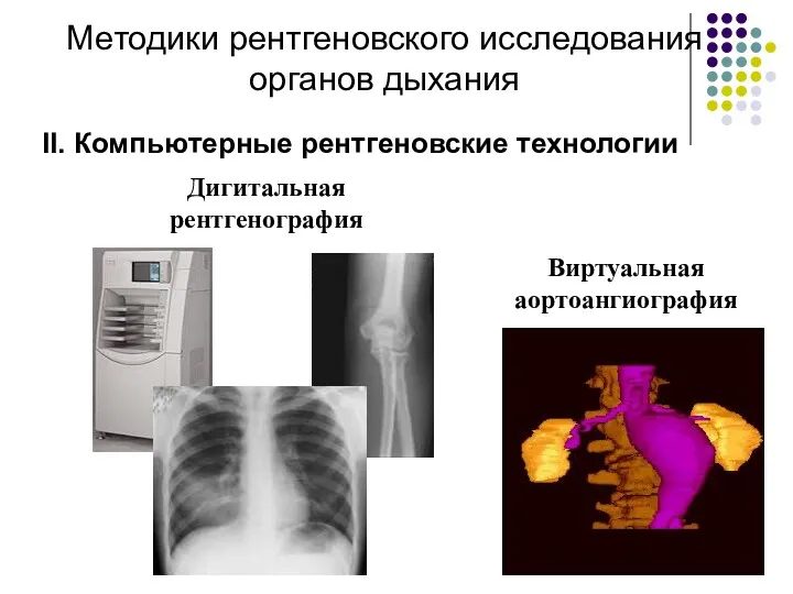 Методики рентгеновского исследования органов дыхания II. Компьютерные рентгеновские технологии Дигитальная рентгенография Виртуальная аортоангиография