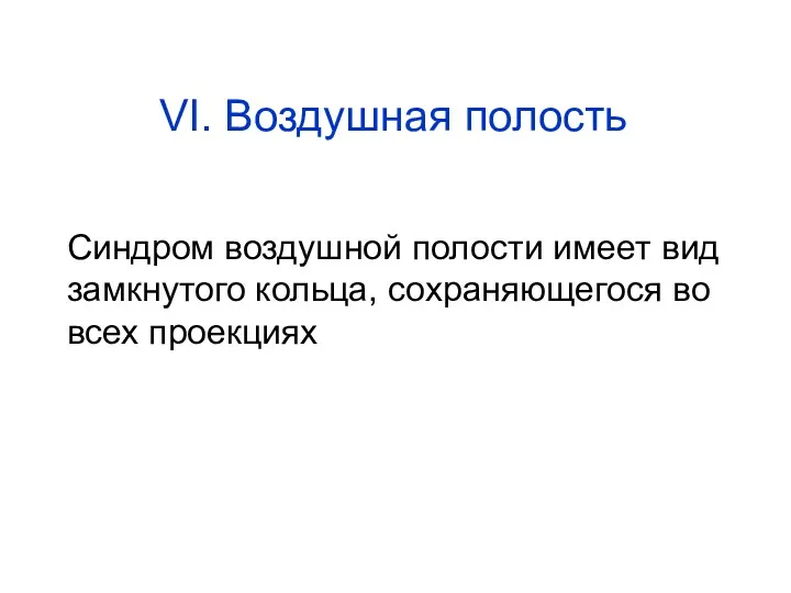 VI. Воздушная полость Синдром воздушной полости имеет вид замкнутого кольца, сохраняющегося во всех проекциях