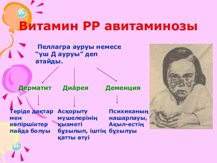 Витамин РР авитаминозы Пеллагра ауруы немесе “үш Д ауруы” деп