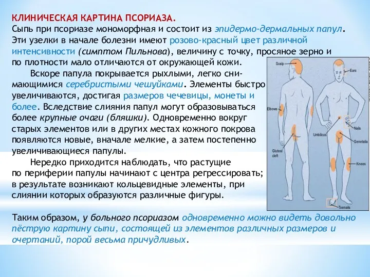 КЛИНИЧЕСКАЯ КАРТИНА ПСОРИАЗА. Сыпь при псориазе мономорфная и состоит из