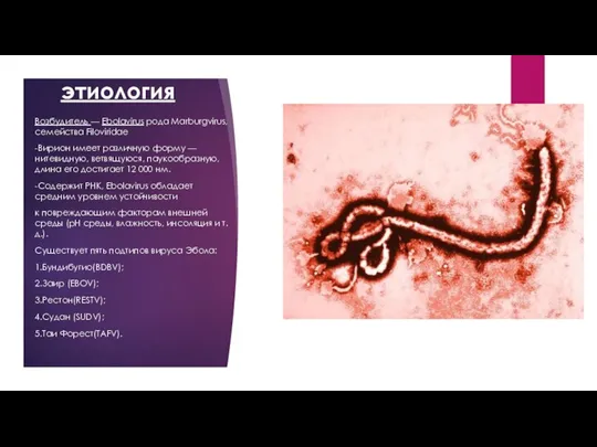 этиология Возбудитель — Ebolavirus рода Marburgvirus, семейства Filoviridae -Вирион имеет различную форму —
