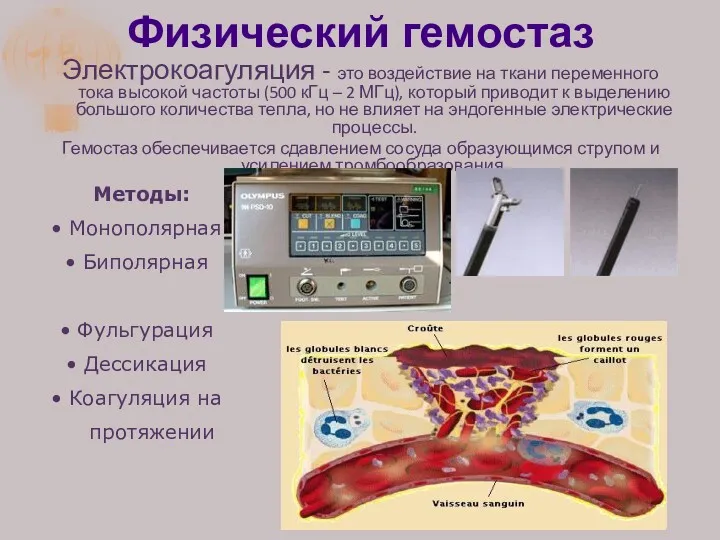 Физический гемостаз Электрокоагуляция - это воздействие на ткани переменного тока