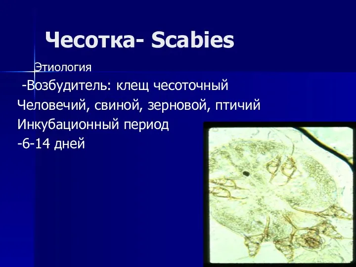 Чесотка- Scabies Этиология -Возбудитель: клещ чесоточный Человечий, свиной, зерновой, птичий Инкубационный период -6-14 дней