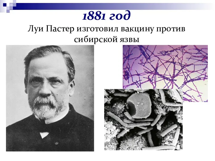 1881 год Луи Пастер изготовил вакцину против сибирской язвы