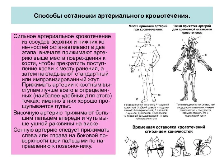 Способы остановки артериального кровотечения. Сильное артериальное кровотечение из сосудов верхних