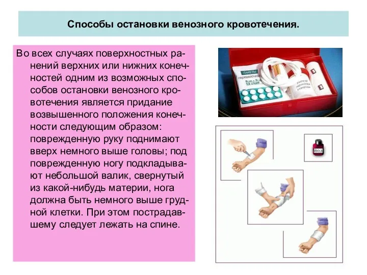 Способы остановки венозного кровотечения. Во всех случаях поверхностных ра-нений верхних