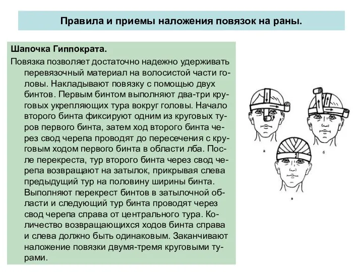 Правила и приемы наложения повязок на раны. Шапочка Гиппократа. Повязка