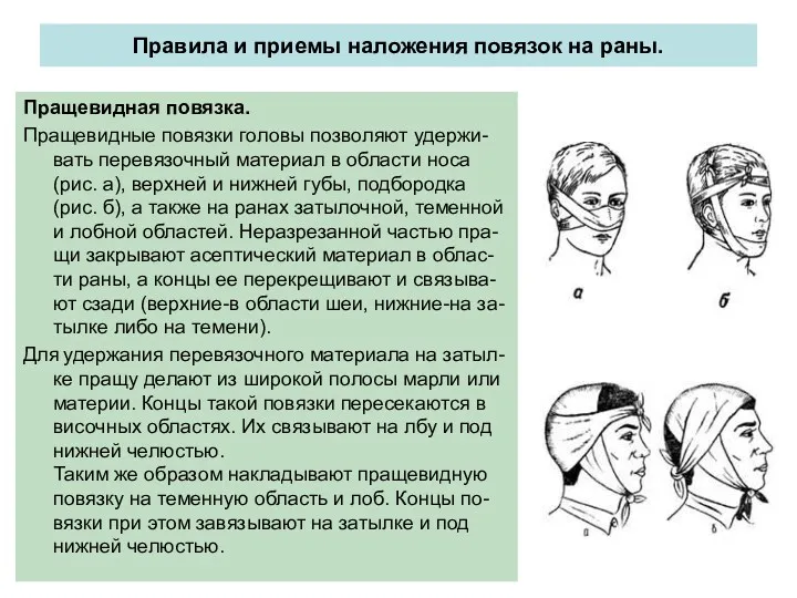 Правила и приемы наложения повязок на раны. Пращевидная повязка. Пращевидные