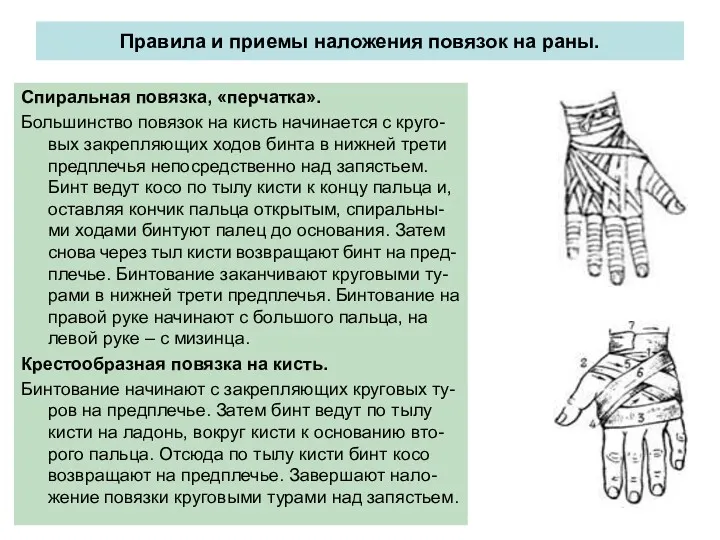 Правила и приемы наложения повязок на раны. Спиральная повязка, «перчатка».