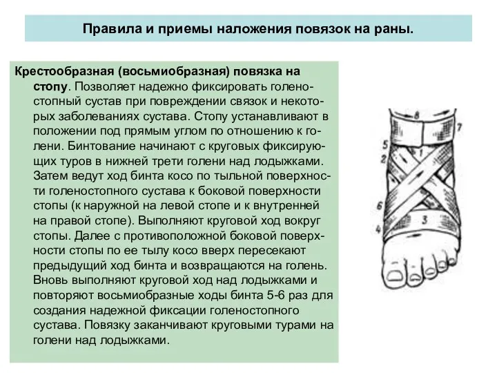 Правила и приемы наложения повязок на раны. Крестообразная (восьмиобразная) повязка