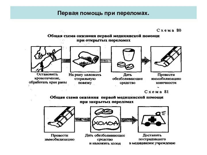 Первая помощь при переломах.