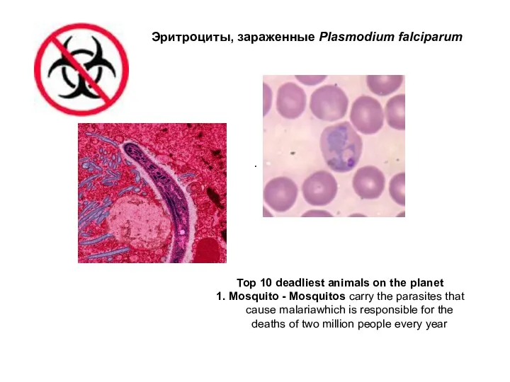 . Эритроциты, зараженные Plasmodium falciparum Top 10 deadliest animals on