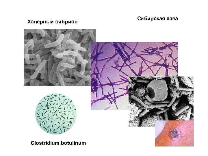 Сибирская язва Clostridium botulinum Холерный вибрион