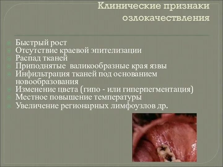 Клинические признаки озлокачествления Быстрый рост Отсутствие краевой эпителизации Распад тканей