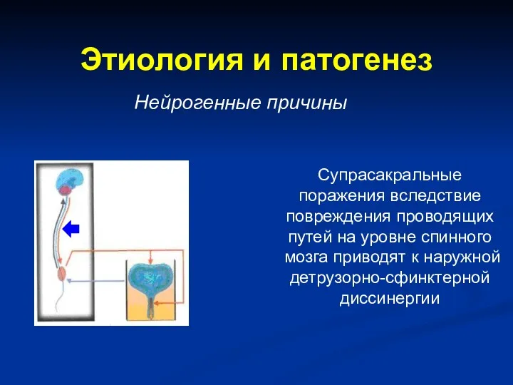 Этиология и патогенез Нейрогенные причины Супрасакральные поражения вследствие повреждения проводящих