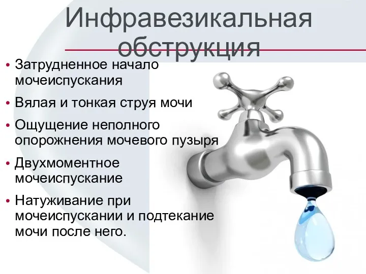 Инфравезикальная обструкция Затрудненное начало мочеиспускания Вялая и тонкая струя мочи